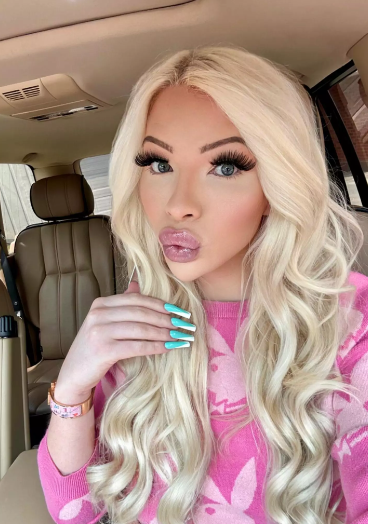 Une femme qui s'était métamorphosée en Barbie souhaite retrouver son apparence «normale».