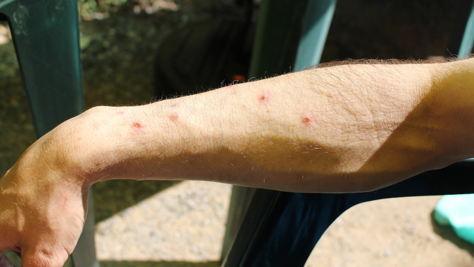 Pourquoi certaines personnes attirent-elles plus les moustiques?