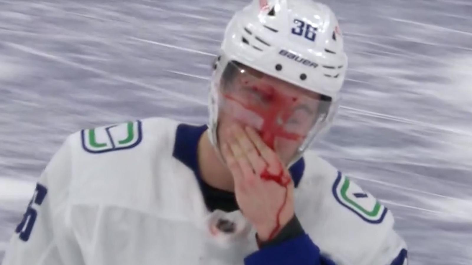 Hoglander takes a slapshot to the face, casually skates off like nothing is wrong