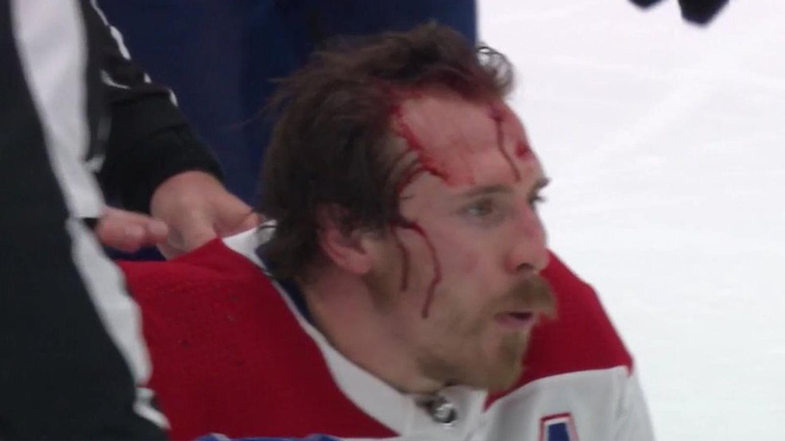 Gallagher loses his helmet, smacks his head on the ice and gets bloodied up badly